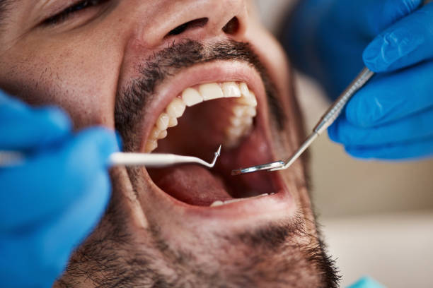 Emergency Dental Services in Alorton, IL